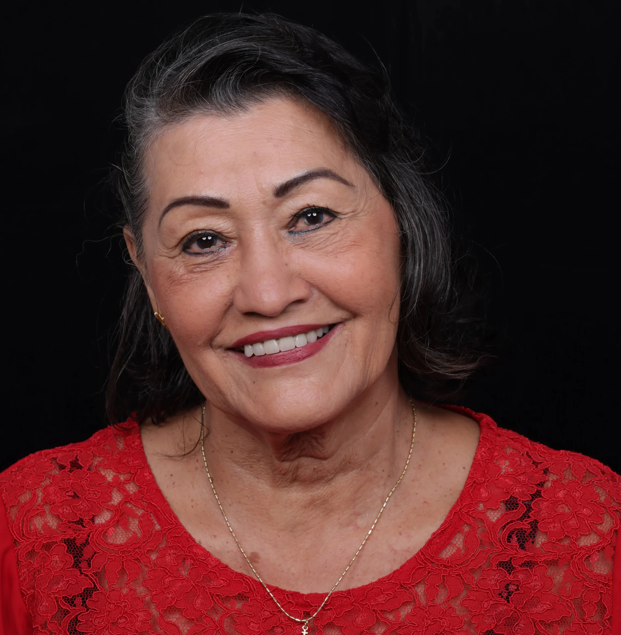 Caso All-on-4 de la Sra. Nubia Parra en la Clínica Odontológica Víctor Rodríguez en Bucaramanga