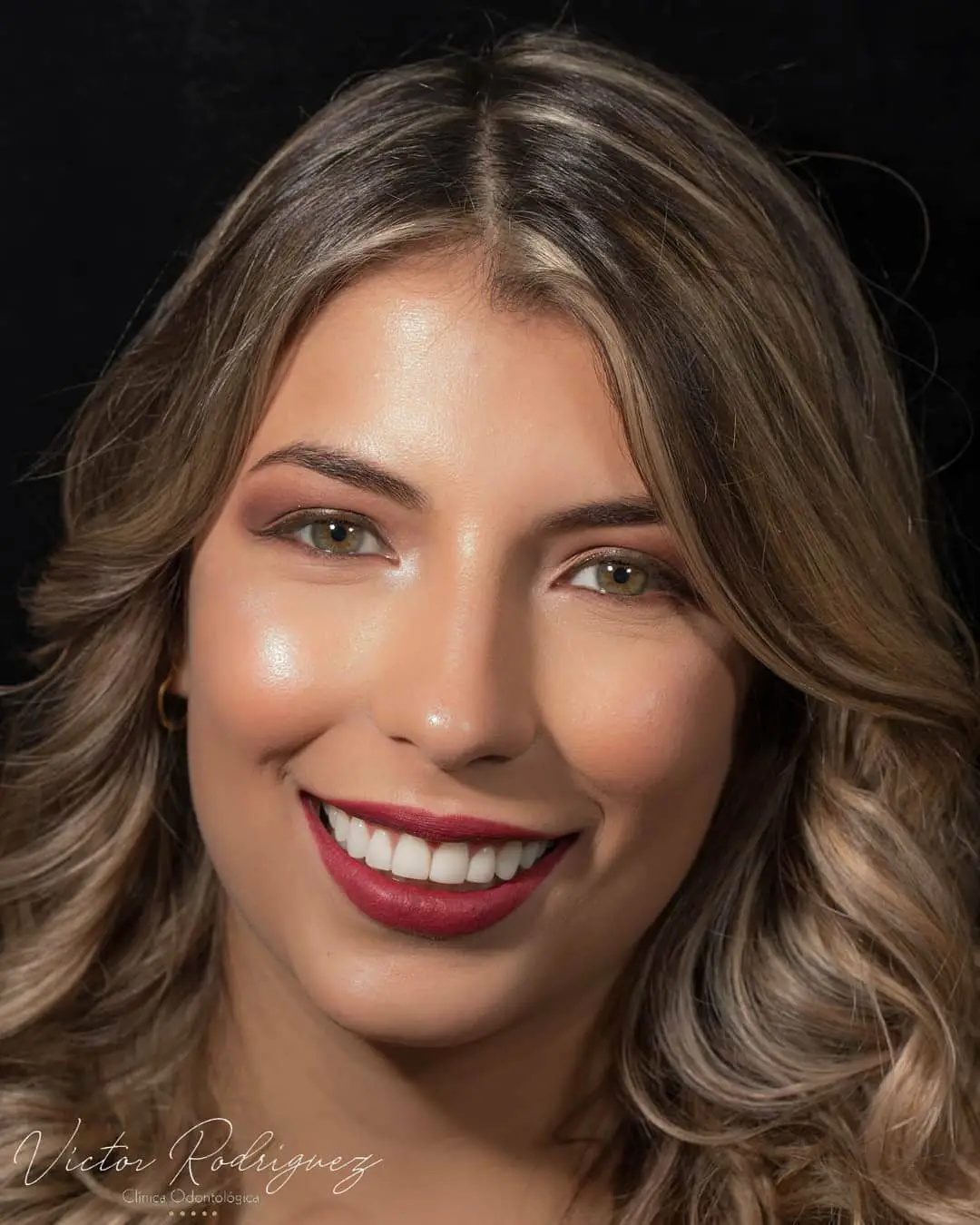 Paciente mostrando una sonrisa estética después de tratamiento dental en la Clínica Odontológica Dr. Víctor Rodríguez en Bucaramanga.