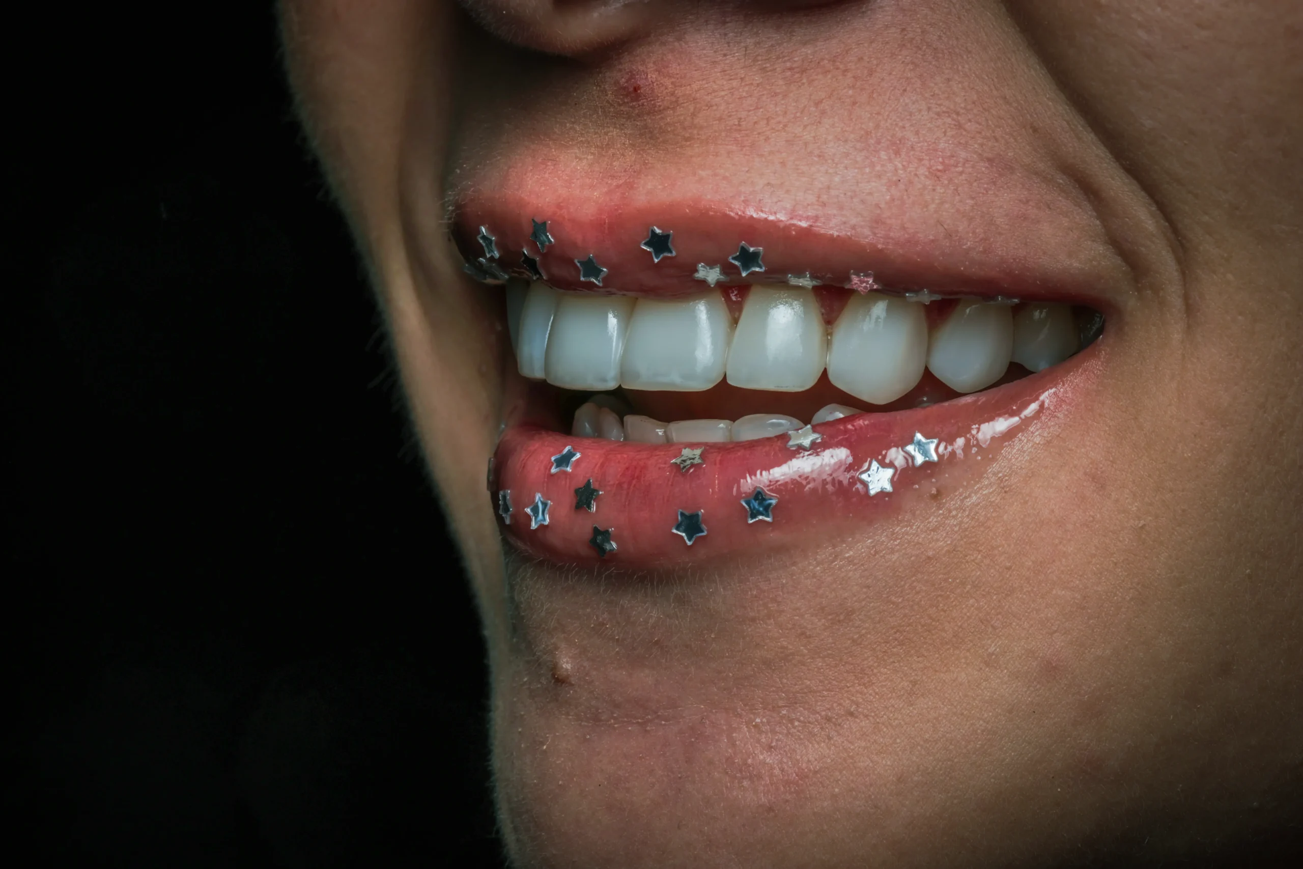 Sonrisa estética dental con dientes blancos y diseño de sonrisa realizado por especialista odontológico