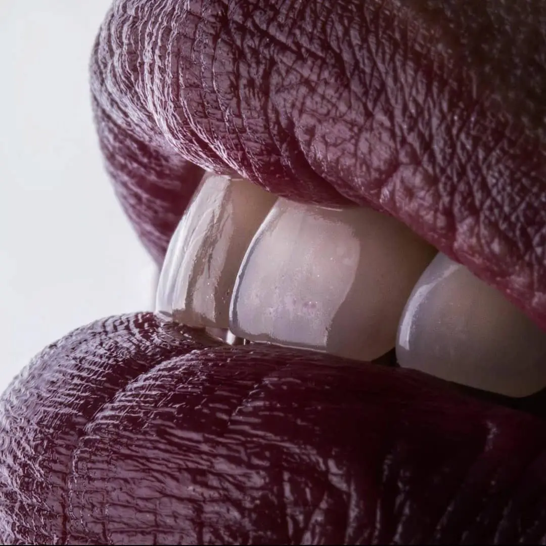 Detalle de sonrisa blanca lograda con tratamientos de estética dental en clínica odontológica en Bucaramanga